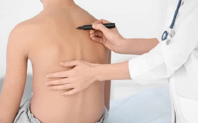 Gù Lưng Có Chữa Được Không? Top 7 Bài Tập Chữa Gù Lưng 3 Thời điểm tốt nhất để điều trị gù lưng là khi bệnh còn ở giai đoạn nhẹ