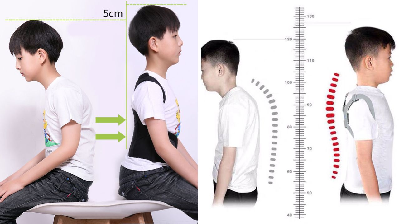 Phòng tránh là chìa khóa: Cách phòng chống gù lưng ở trẻ nhỏ 1 cach phong chong gu lung o tre nho 2