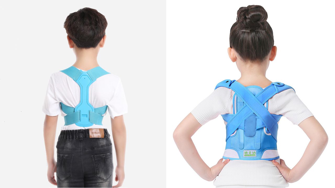 Phương pháp điều trị và phục hồi cho trẻ bị gù lưng