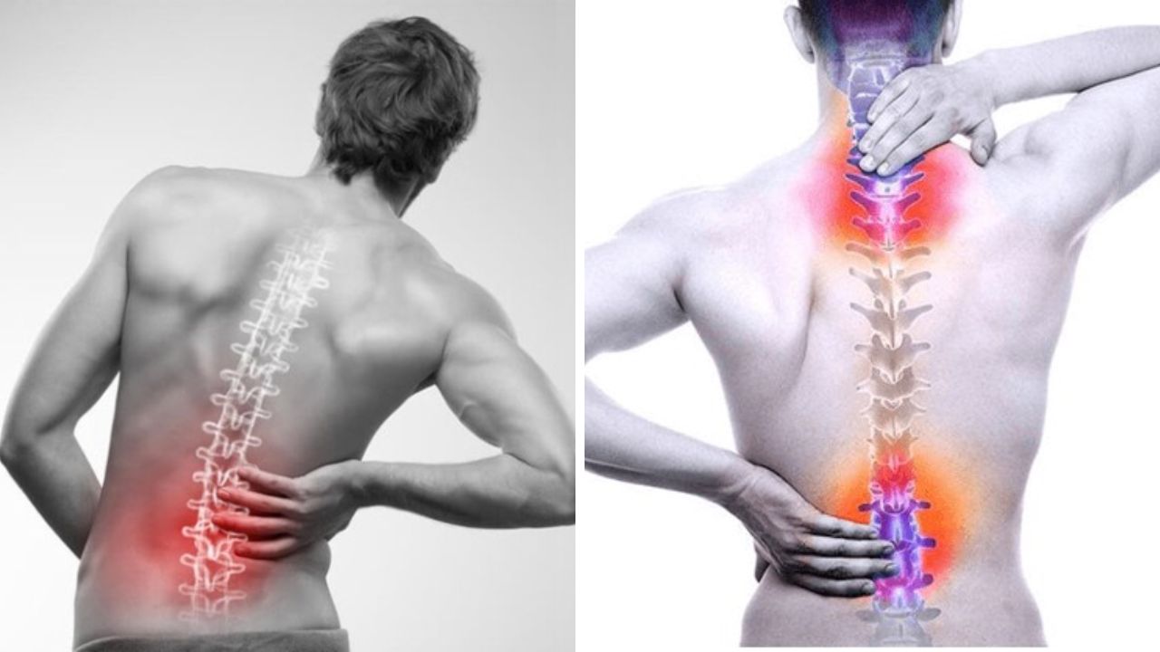 Tổng quan về đau lưng Tổng quan về đau lưng